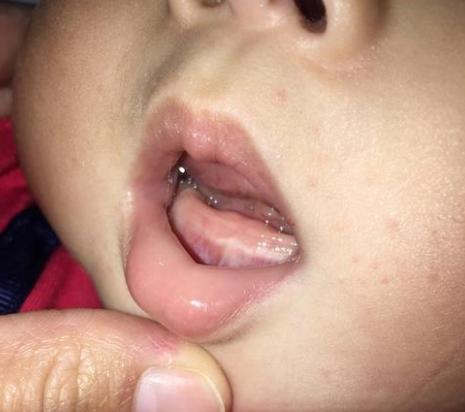 宝宝从三个月到七个月一直流口水,三个月宝宝突然口水变多还吐泡泡