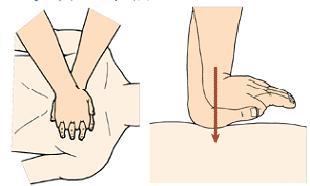 心肺复苏胸外按压的正确部位,电工考试心肺复苏的正确步骤