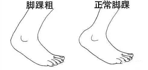 脚踝粗适合穿什么鞋子,脚有点胖适合穿什么鞋子