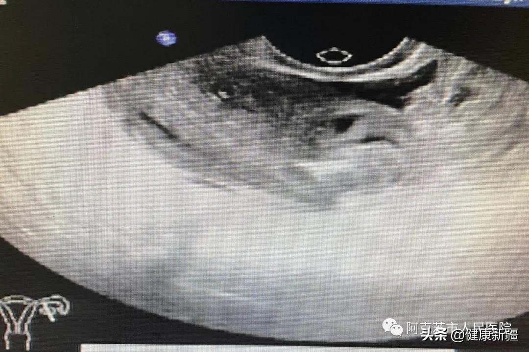 阿克苏地区第一人民医院超声科,阿克苏地区人民医院超声科