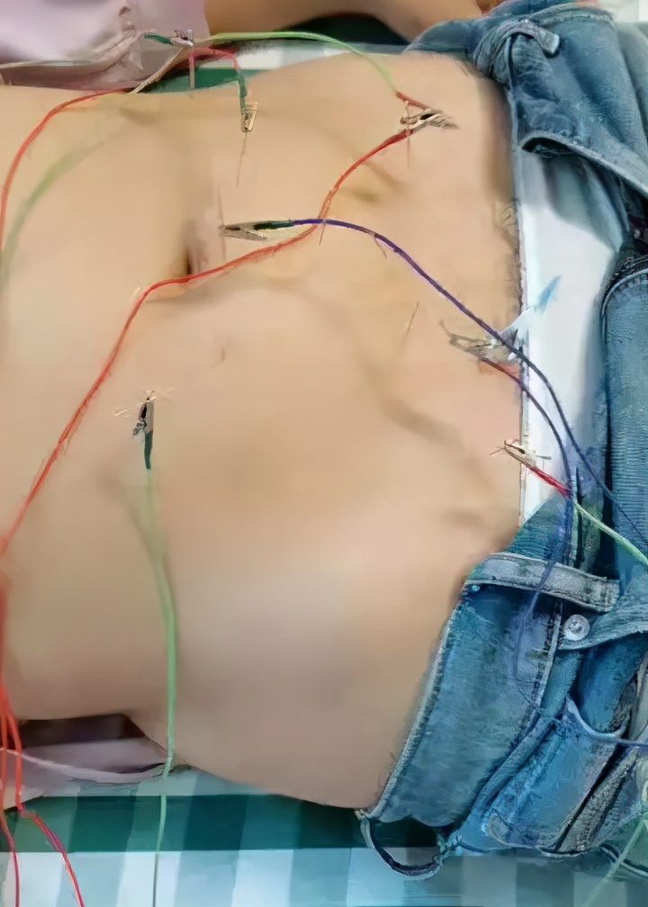 爱心助孕，圆梦母亲|生殖医学科母亲节活动+公益项目预告