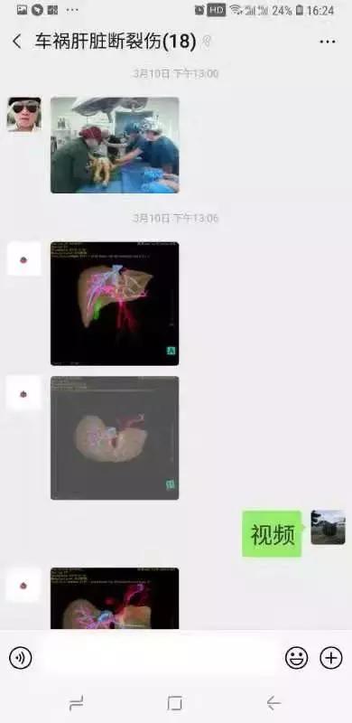 青岛4岁男童死亡,青岛4岁男孩车祸去世