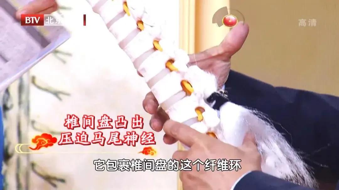 腰椎受损会导致漏尿怎么办,脊椎损伤导致漏尿怎么办