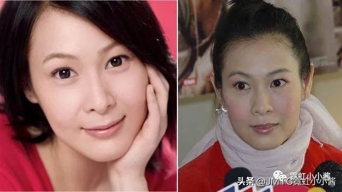 25岁抗老拯救垮脸,哪种脸型抗衰抗皱