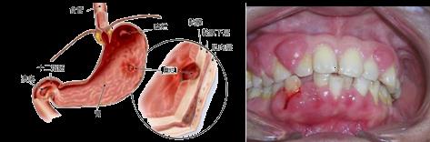 抗血小板药物停多久可以手术,抗血小板治疗药物
