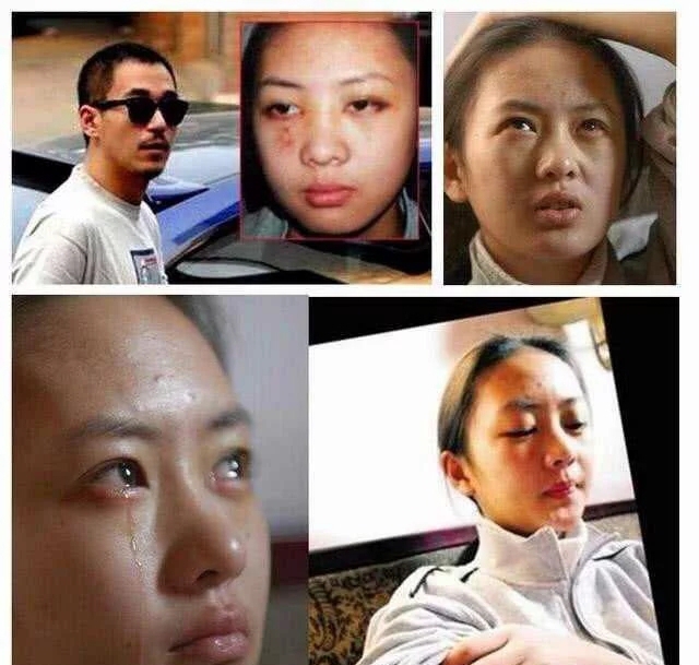 张默当年打童瑶的事,当年张默打童瑶的事