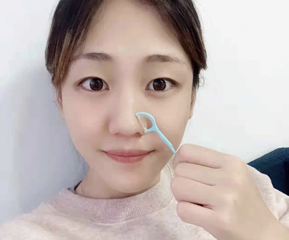 去黑头酒糟鼻有什么好的药膏,酒糟鼻祛黑头