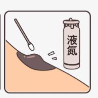 「健康」人无大“痣”,未必不是好事