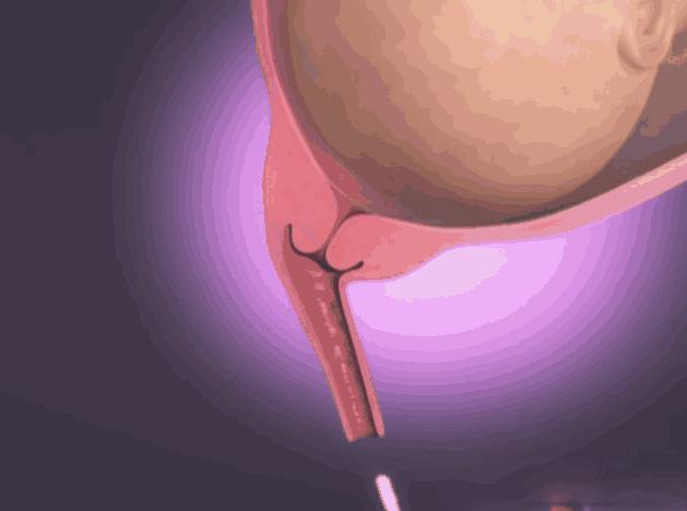 临近预产期见红会一直流血吗,别慌意思是什么