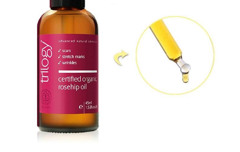 巧用玫瑰果油你get到了吗,使用玫瑰果油淡斑效果