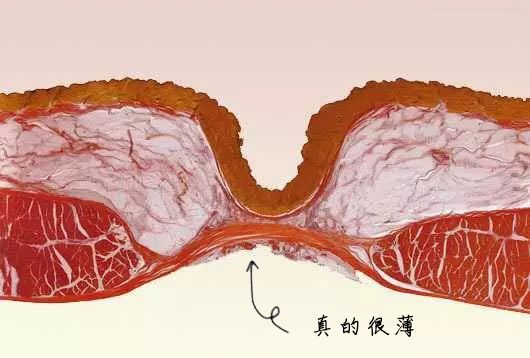 肚脐能抠吗有趣讲解,肚脐能抠破吗