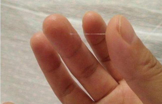 排卵期有拉丝分泌物是排卵吗,排卵期白带多是卵子质量好吗