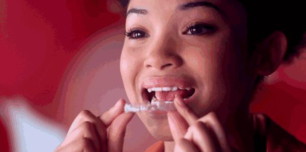 钢牙和隐形牙套怎么选择,钢牙和半隐形牙套有什么区别