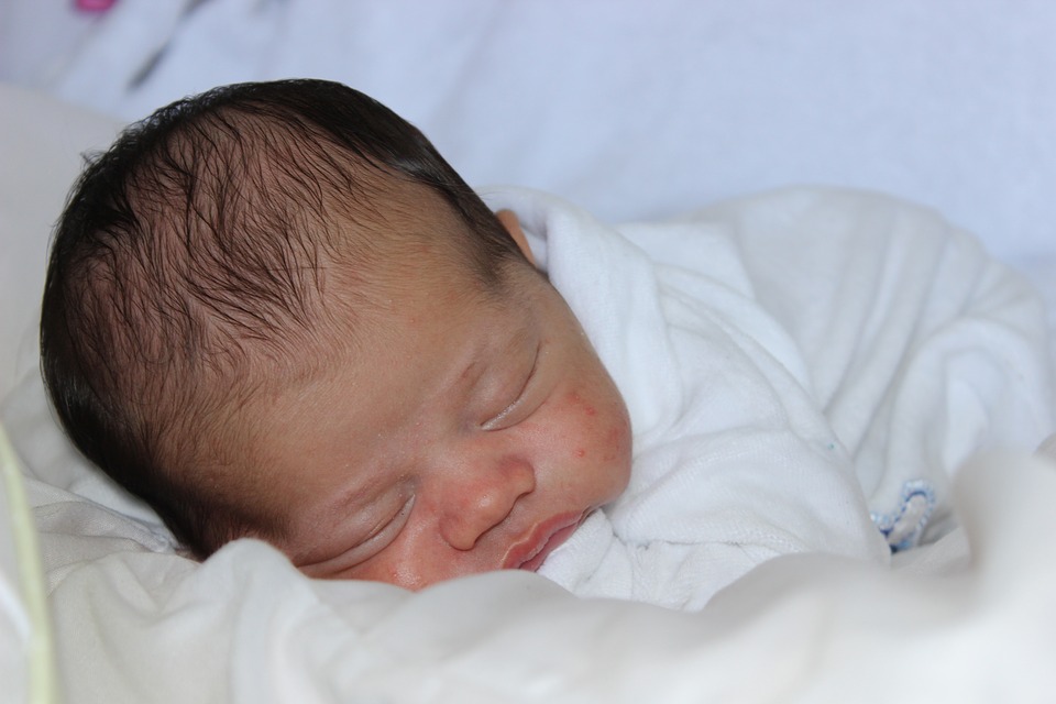 新生儿出现脱皮,新生儿34天脱发正确方法