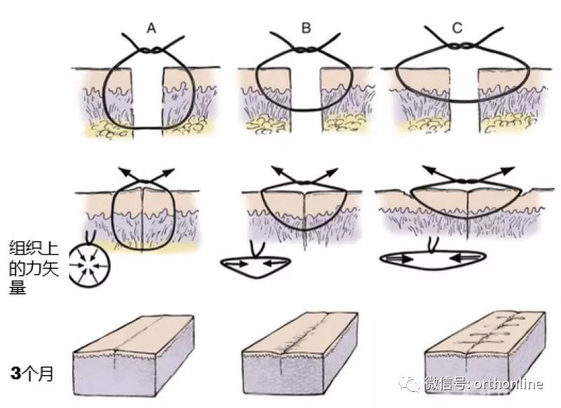 临床清创原则,临床清创