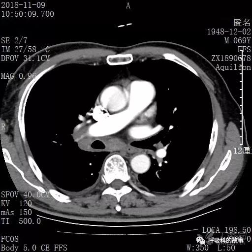 怎么应用统计学做调查,统计学方法可以解决的主要问题