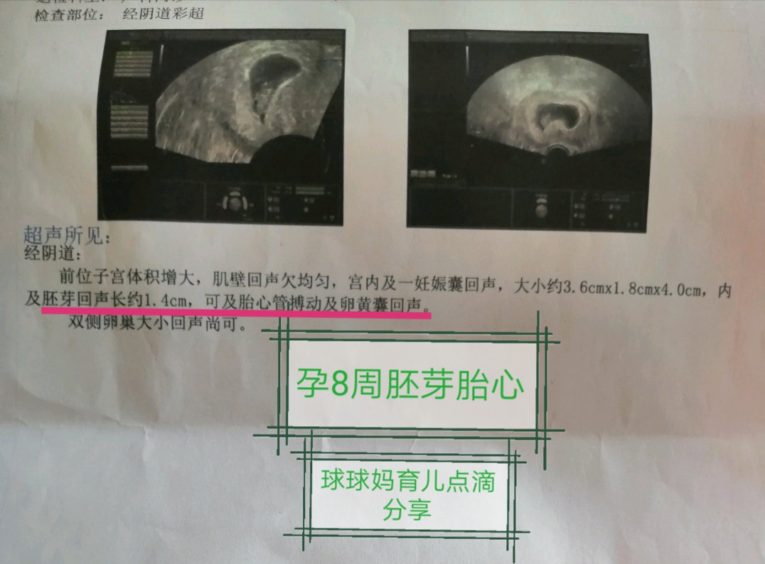 孕期报告单大全,孕期检查报告有哪些