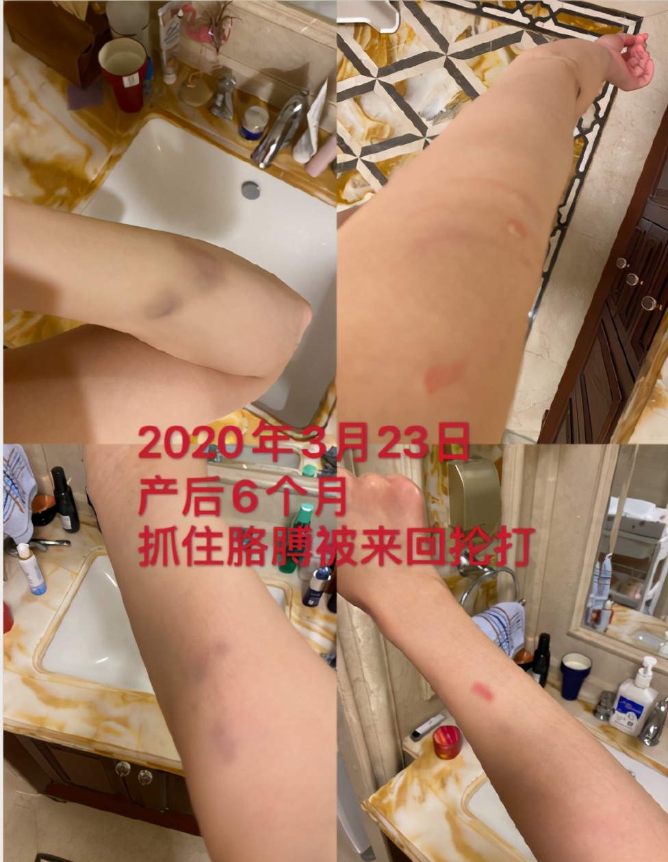 人面兽心家暴男,人面兽心家暴后续