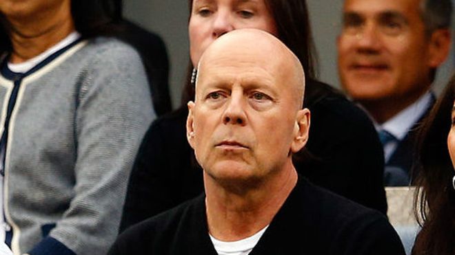 秃头有哪些意想不到的好处？