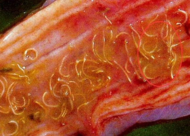 男子吃鱼生浑身肝吸虫图片,体检查出肝吸虫