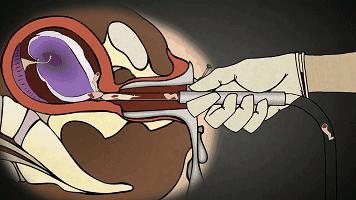 被孩子撞见你们在干嘛怎么回答,被孩子撞见了你该如何去解释