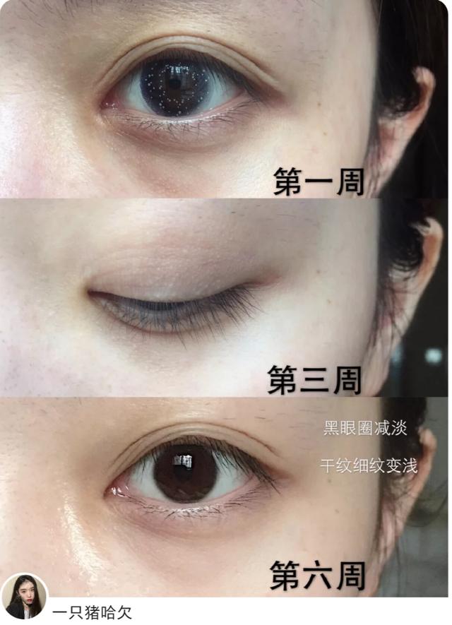 4款国货眼霜,眼霜红黑榜贵妇