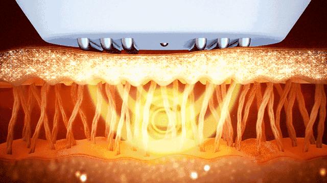 医美最应该做的项目有哪些,最常见的医美项目