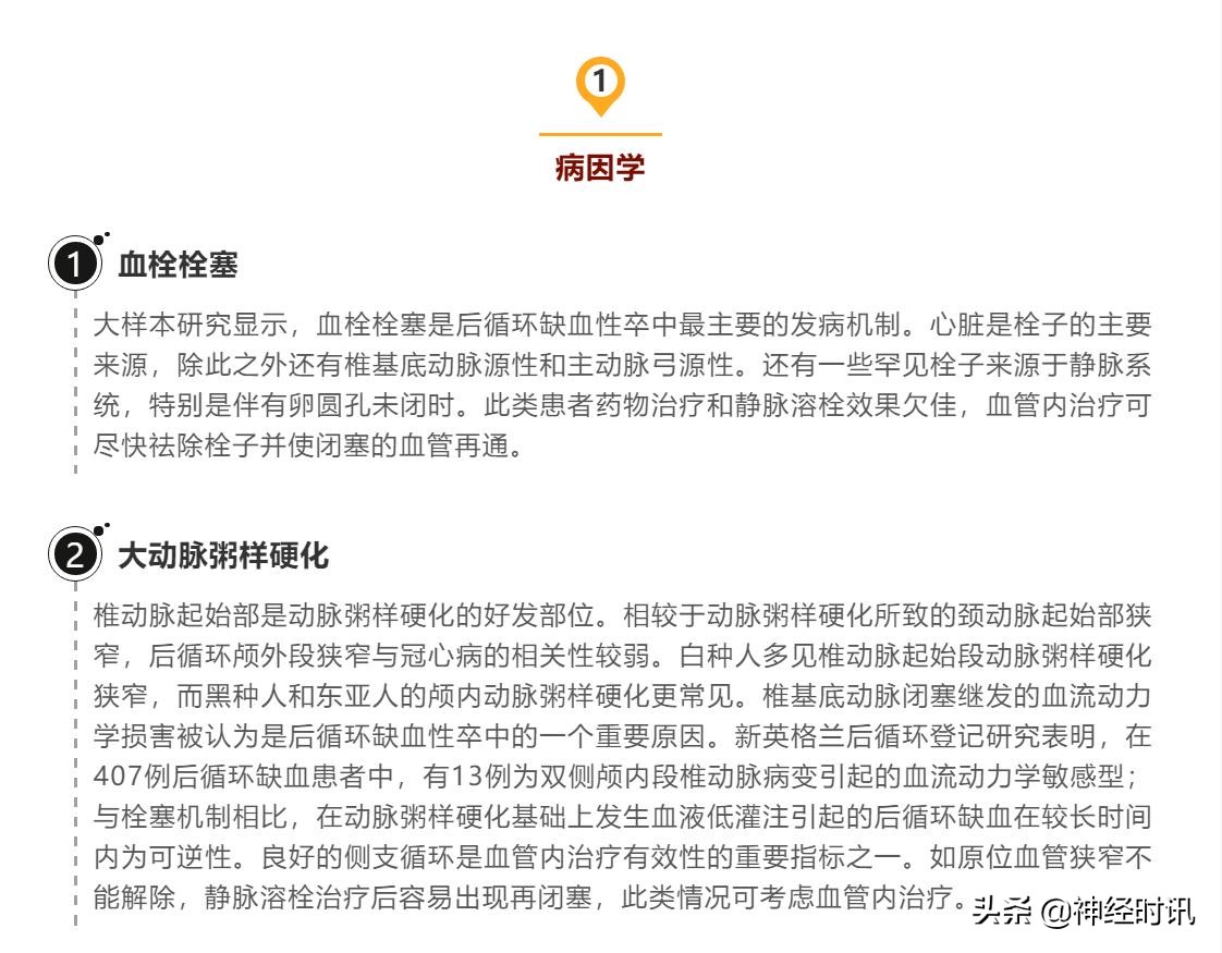 后循环缺血性卒中,后循环缺血性卒中眩晕