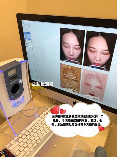 皮秒激光香港,香港祛斑产品推荐