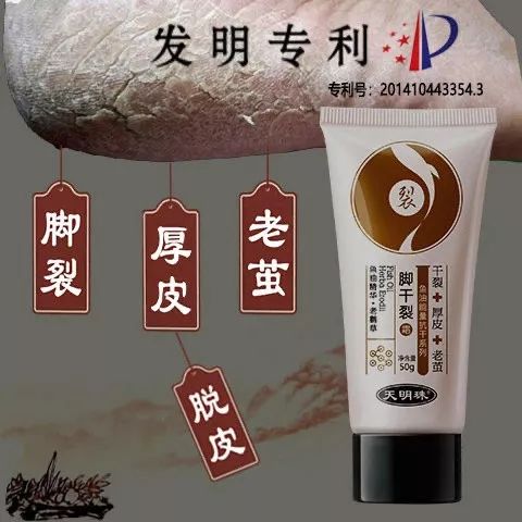 冬天脚后跟干裂用什么润脚霜,润足脚后跟干裂修复霜