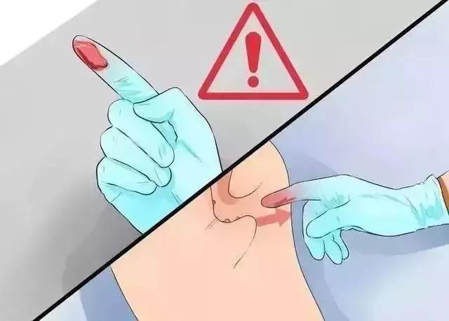 这一项“羞羞”的检查，2分钟查出直肠癌，可惜好多人都不做