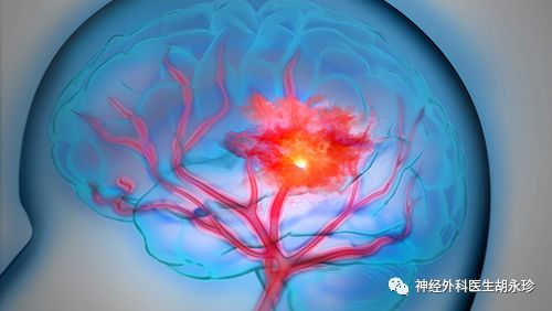 脑出血后吞咽功能如何恢复,脑出血手功能恢复方法