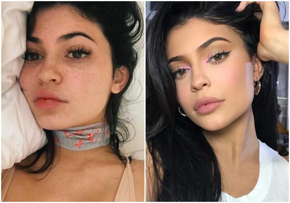 瞬间让脸变白的神器,让斑快速消失