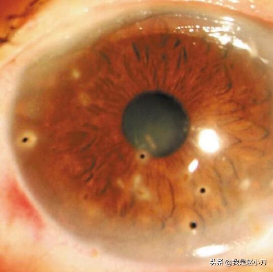 板栗大丰收了,今年的板栗大丰收