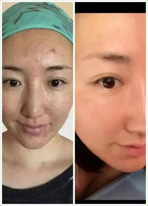 「*今条头日**」护肤的步骤是什么？擦护肤品的正确步骤是什么？