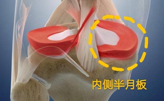 骨科医生教你一招搞定膝盖痛,不同部位膝关节