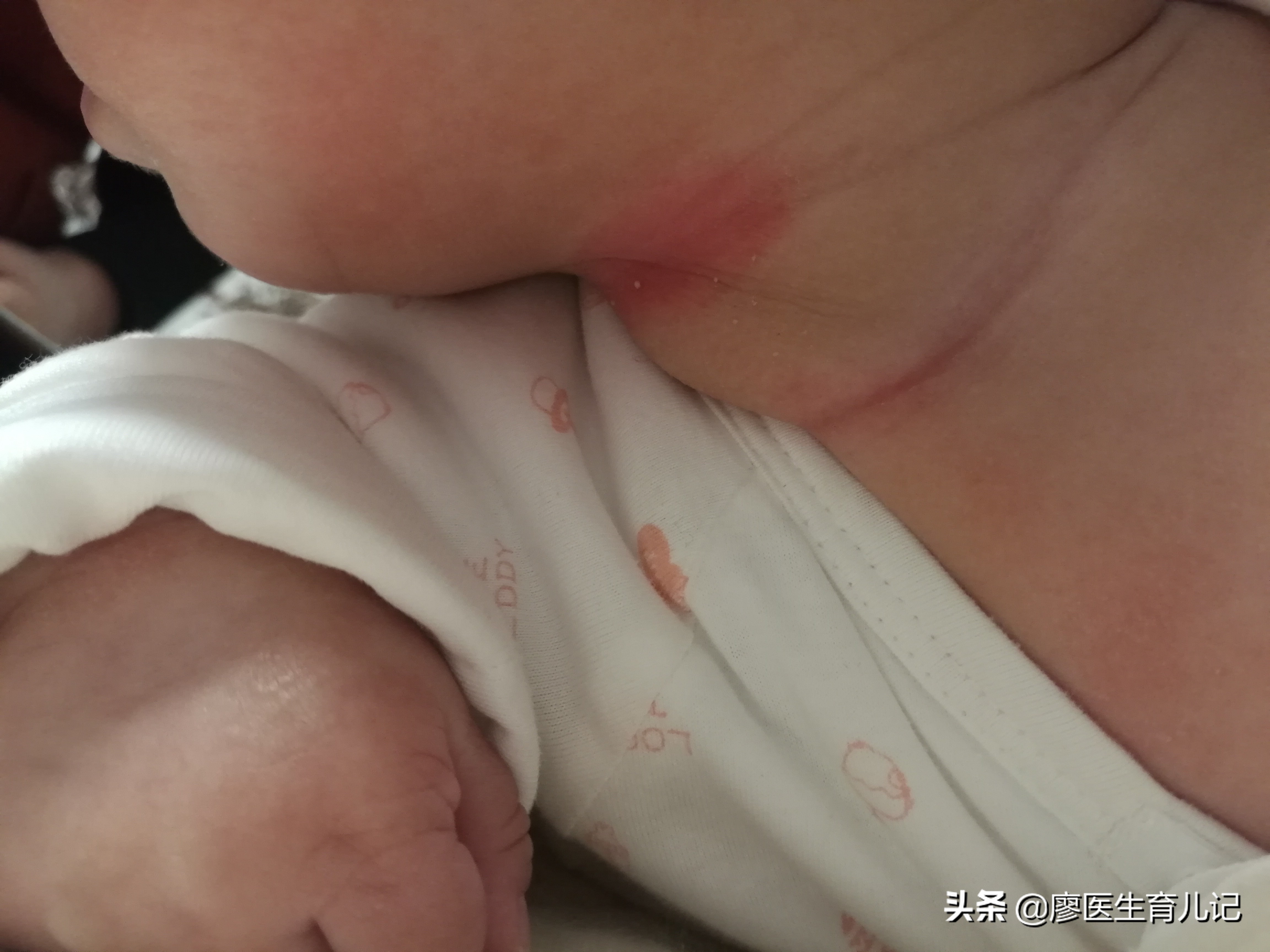 红脖子！我踩过的坑，您就不要再往下跳了。