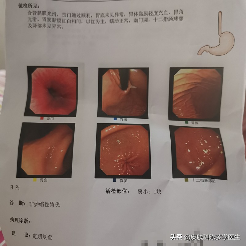 医生无麻醉给自己做了个胃肠镜,我是医生免费观看完整版