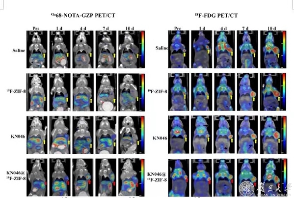 肿瘤医院宋少莉,复旦肿瘤宋少莉