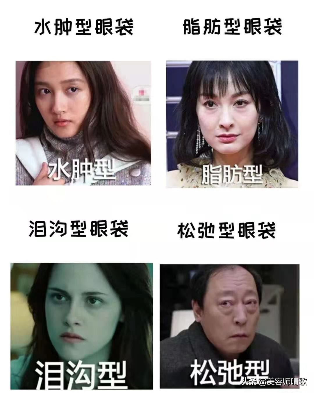 目前最有效的去眼袋方法,有啥好办法能去大眼袋