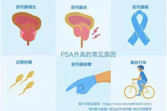 50岁男人psa早期症状,男性检查psa注意事项