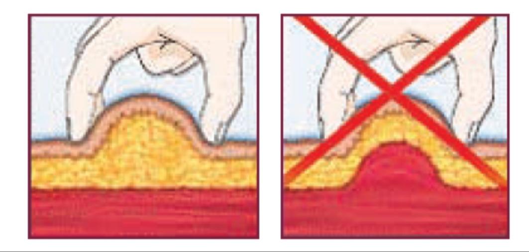 鐙楃嫍鐤嫍姝g‘娉ㄥ皠鏂规硶,鐙楃嫍娉ㄥ皠鐤嫍瑙嗛鏁欑▼