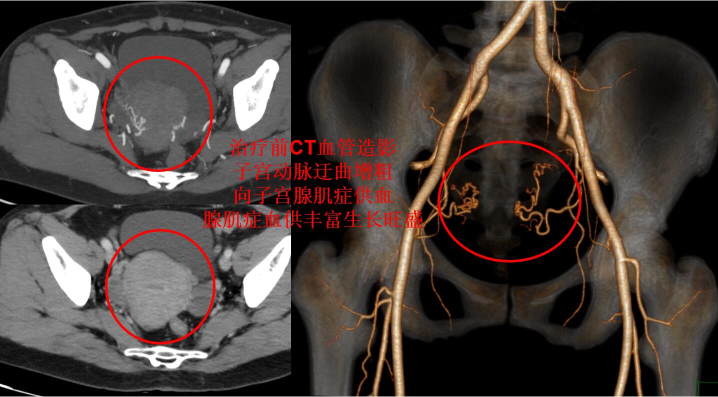 心脏做过手术需要常年吃药吗,心脏做过大手术后能干重活吗