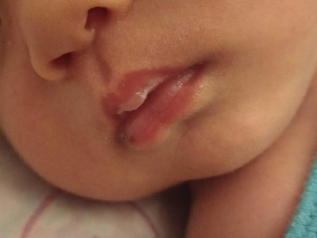 嘴巴大的小孩适合什么安抚奶嘴,超薄安抚奶嘴防止嘟嘟嘴