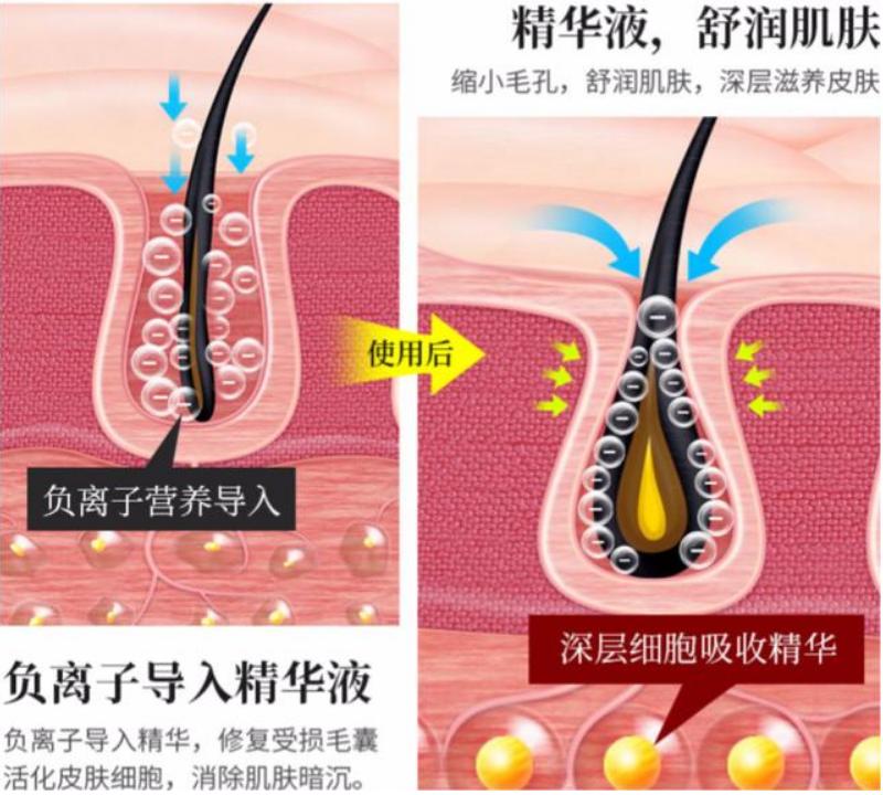 美容针变“毒针”，19岁女孩被毁容，医生：打针有风险跟风需谨慎