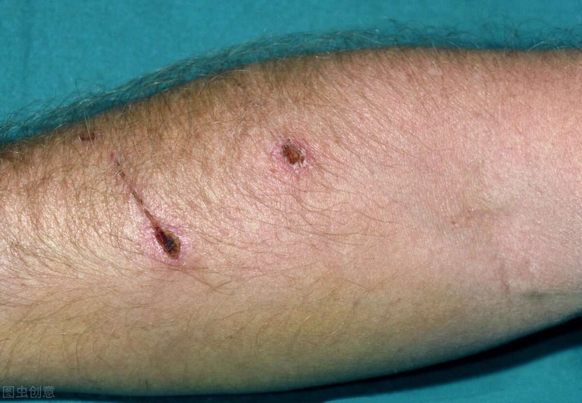 世界狂犬病日中国狂犬病发病情况,世界狂犬病间接传播