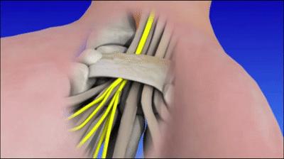 手麻是什么原因造成的怎样治疗,手麻是五种原因引起的要警惕