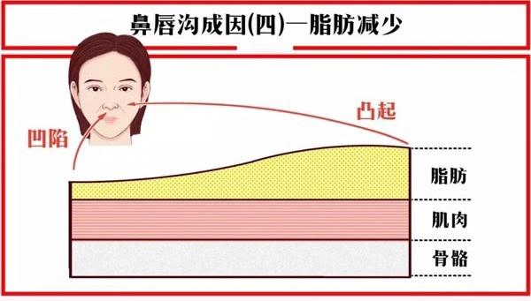 关于法令纹的冷知识,关于法令纹的误解你中招了吗
