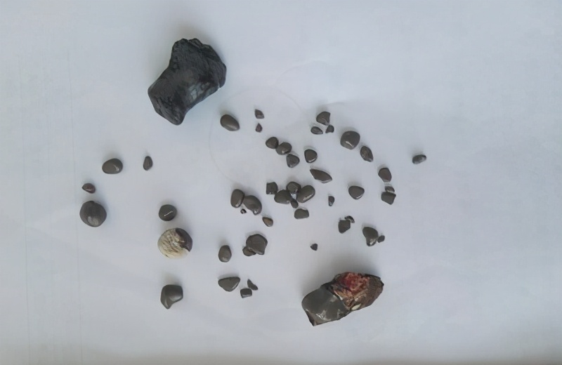 尿黄异味有泡沫是肾有问题吗,尿尿泡沫很多有沉淀物