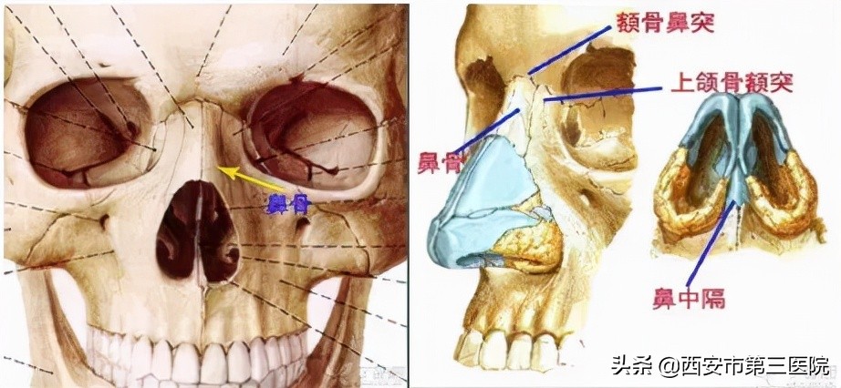外鼻先天性畸形,外鼻畸形是什么原因